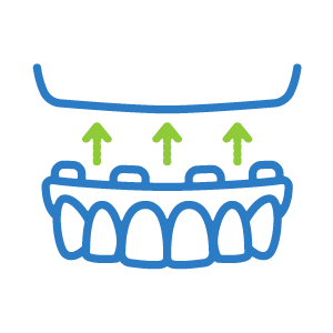 Port Orchard Full Arch Dental Implants