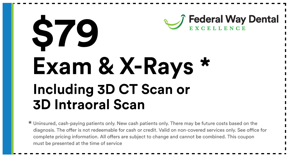 $109 Exam and X-Rays
