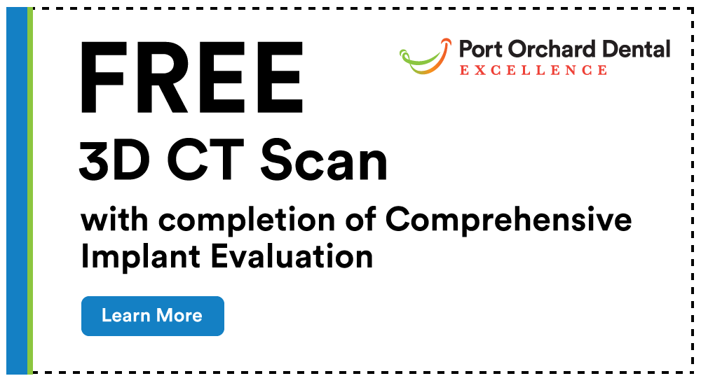 Free 3D CT Scan with completion of comprehensive implant evaluation