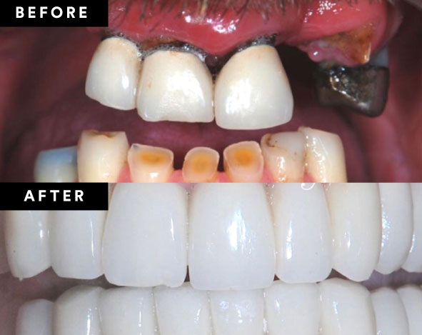 Before and After Gallery